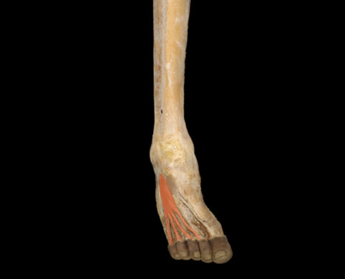 term image