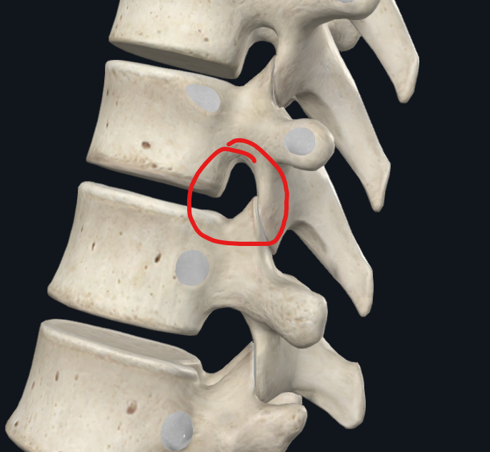 <p>Circled</p>
