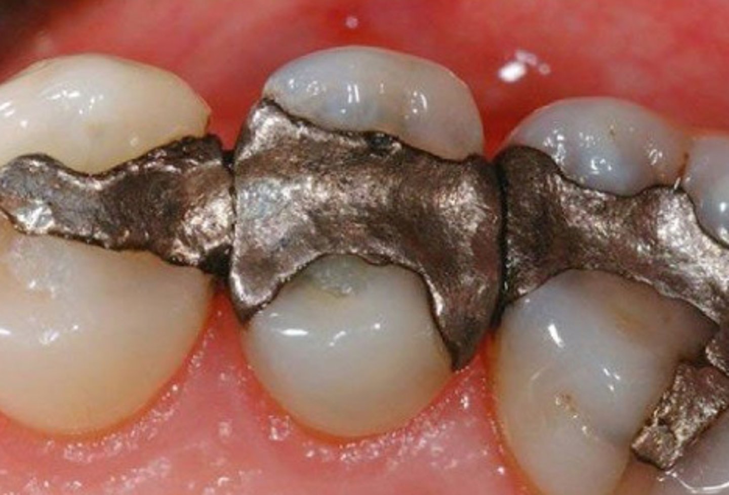 <p>What caused this defect?</p>