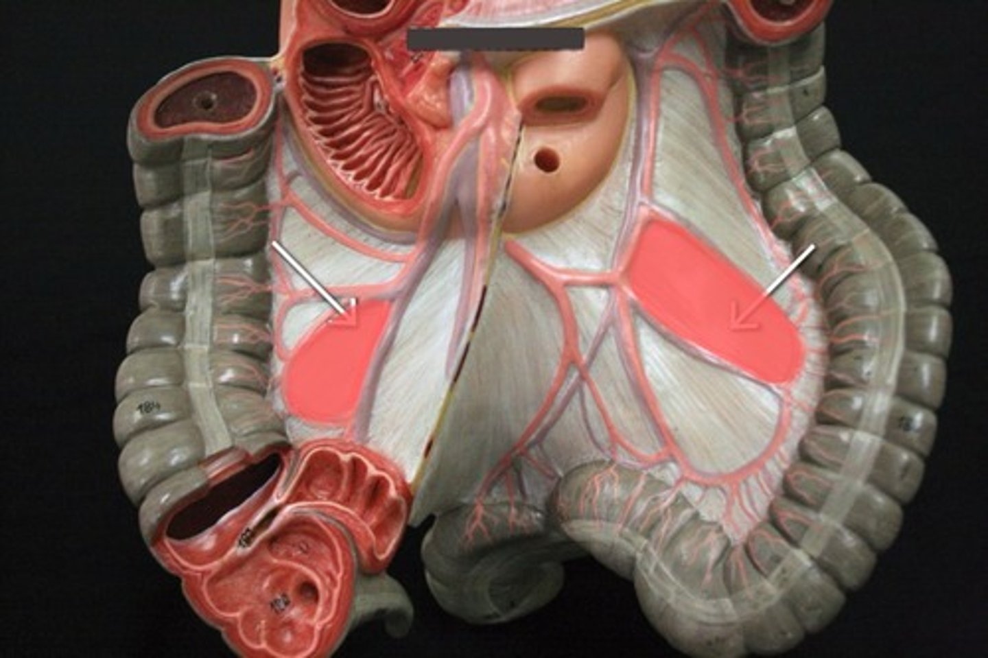<p>Region of descending colon and ascending colon</p>