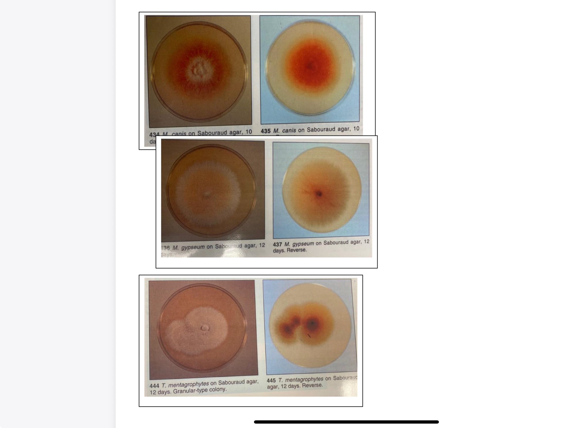 <p>SAB dextrose agar with the addition of chloramphenicol and cycloheximide (SAB CC) is a highly selective medium for the isolation of dermatophytes from cutaneous specimens. This agar inhibits the growth of saprophytic bacteria and fungi present on the animal’s skin and hair.</p>