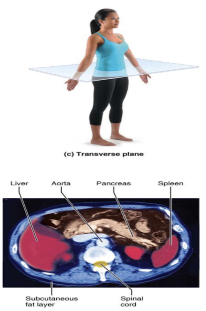 <p>transverse (horizontal plane)</p>