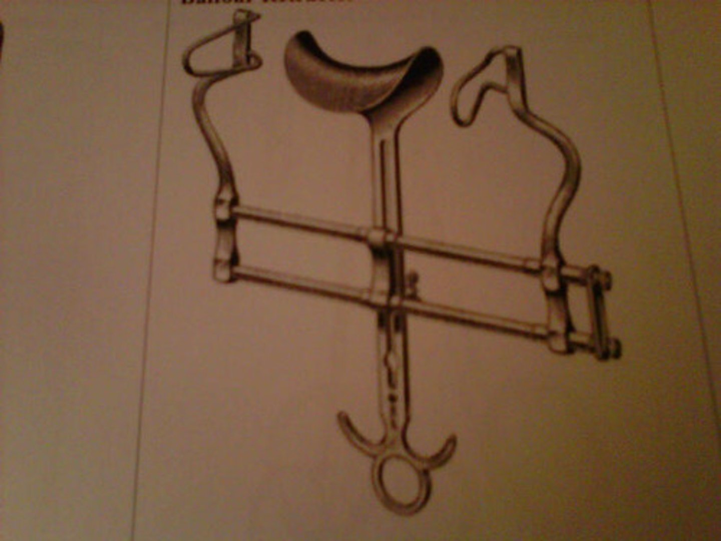 <p>Provides increased exposure of abdominal cavity.</p>
