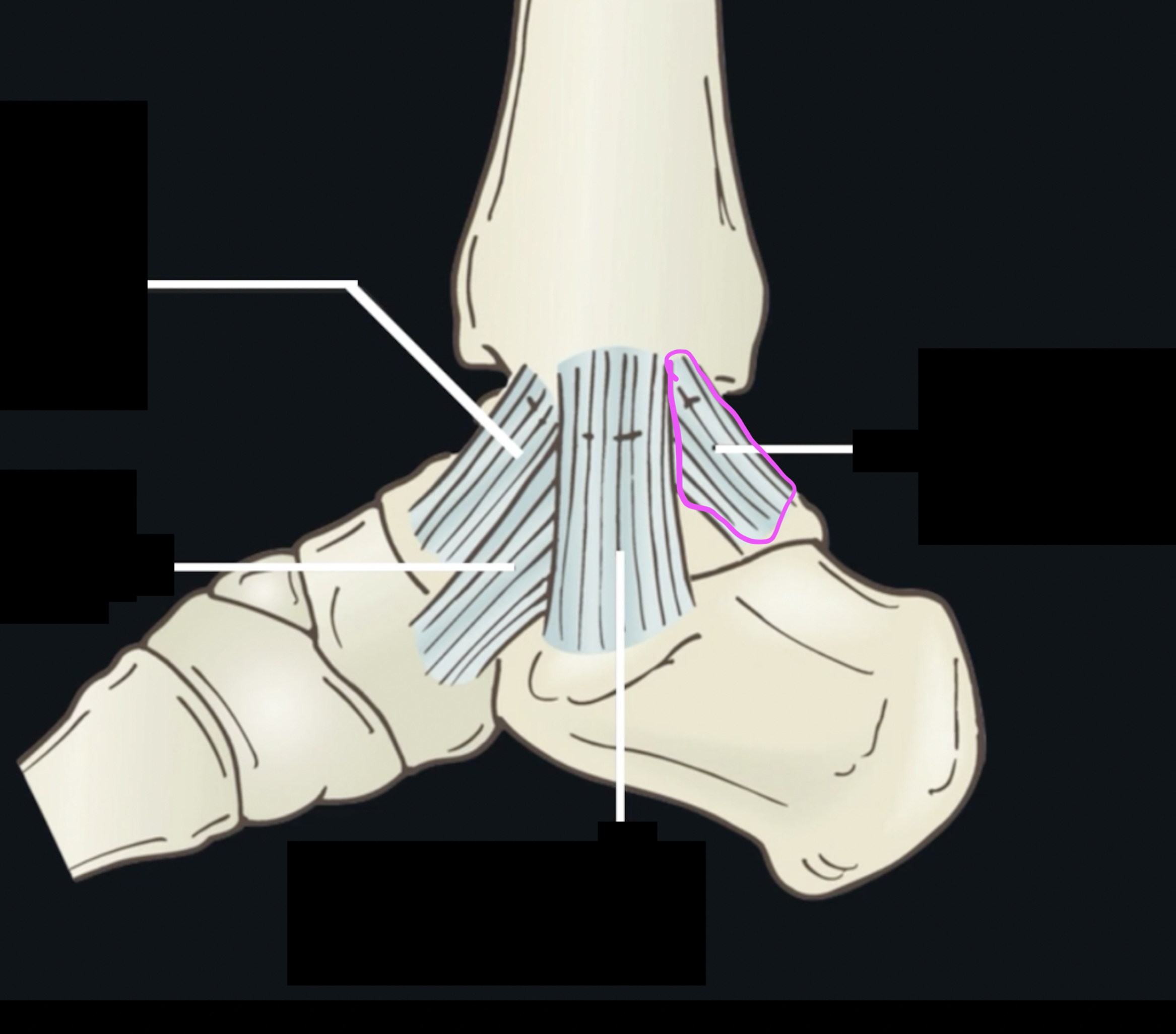 <p>What ligament is this? </p>