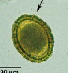 <p>Small, dark egg with a thick proteinaceous coating</p>
