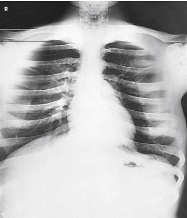 <p>What projection, position and anatomy is this?</p>