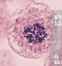 <p>chromatin condenses into chromosomes, and mitotic spindle starts forming</p>