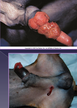 <p><span>Penile Amputation</span></p>