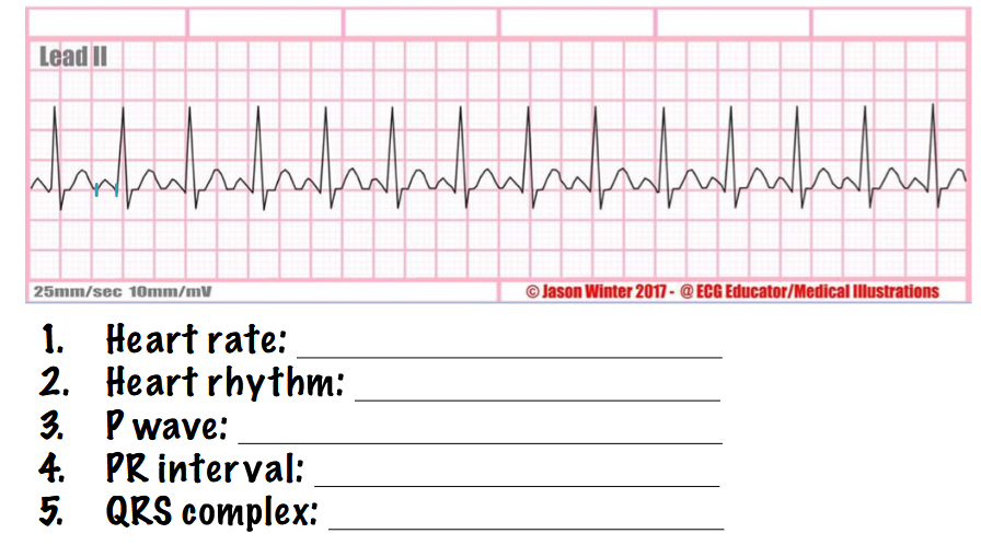 <p>what type of rhythm is this? answer the questions</p>