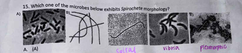 <p><span>Which one of the microbes below exhibits Spirochete morphology?</span></p>