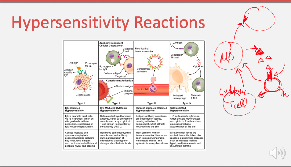 <ul><li><p><strong>T-cell mediated (delayed) response</strong> — <strong>no antibodies involved.</strong></p></li><li><p><strong>Cytotoxic T cells</strong> and <strong>Th1 cells</strong> release cytokines → macrophage activation → tissue injury.</p></li><li><p><span style="color: blue;">Examples: <strong>Contact dermatitis, TB skin test, type 1 diabetes, multiple sclerosis.</strong></span></p></li></ul><p></p>