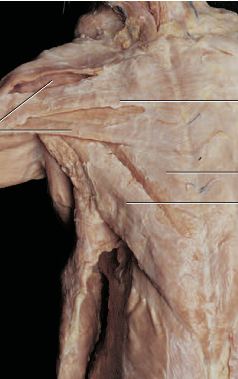 <p>Which muscle group is shown? </p>
