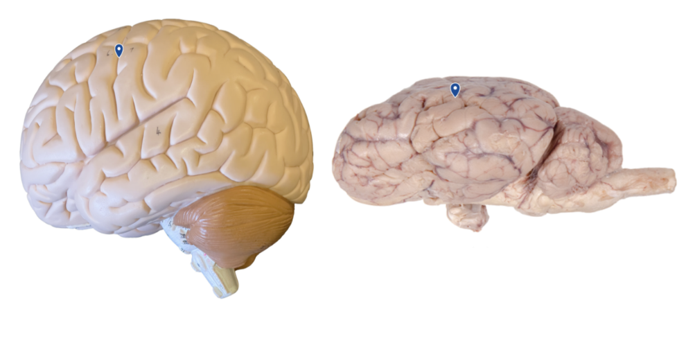 <p>What lobe is the arrow pointing to?</p>