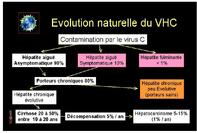 <p>Flaviviridae, virus ARN de polarité (+), enveloppé</p><p>→ 6 génotypes (sévérité des lésions et difficulté de traitement dépend du génotype)</p><p>Présence séquence IRES → Liaison des ribosomes préférentiellement à cette amorce → synthèses des protéines virales devient “prioritaire”)</p><p></p><p>Epidémiologie =</p><p>Transmission sanguine</p><p>Transmission sexuelle? (oui mais facteur moins important que sanguin)</p><p>Transmission materno-foetale réduite (existe mais rare)</p><p>Transmission néonatale: hépatite bénigne</p><p></p><p>Physiopathologie =</p><p>Multiplication dans le foie et libération dans le sang (cible = monocyte)</p><p><strong>Forme asymptomatique fréquente</strong> (problème car…), <strong>Chronicité élevée → cirrhose </strong>(après >10 ans) <strong>→ hépatocarcinome</strong></p><p></p><p>Traitement =</p><p>Portage chronique? Fibrose?</p><ul><li><p>Anciennement: IFN alpha + ribavirine (analogue nucléosidique)</p></li><li><p>Meilleure chance de réponse si faible charge virale, si fibrose peu sévère et si génotype 2 ou 3</p></li><li><p>Bi- Trithérapie → avec un inhibiteur de la protéase NS3: Bocéprévir ,</p><p>siméprevir , télaprévir , paritaprévir</p></li><li><p>Plus récemment, développement d’inhibiteurs de la RNA polymerase , exemples :</p><ul><li><p>Daclat asvir (NS5A ): inhibiteur non nucléosidique pangénomique du complexe de réplication</p></li><li><p>Sofosbuvir NS5B) : inhibiteur nucléotidique pangénomique</p></li></ul><p>→ bithérapie avec ou sans ribavirine (si génotype 2)</p></li></ul><p></p>