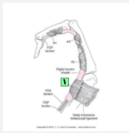 <p>1</p><ul><li><p>Annular pulleys at MCP, PIP, and DIP joints</p></li><li><p>Acts as tunnels which tendons pass through to maintain finger alignment</p></li></ul><p></p>