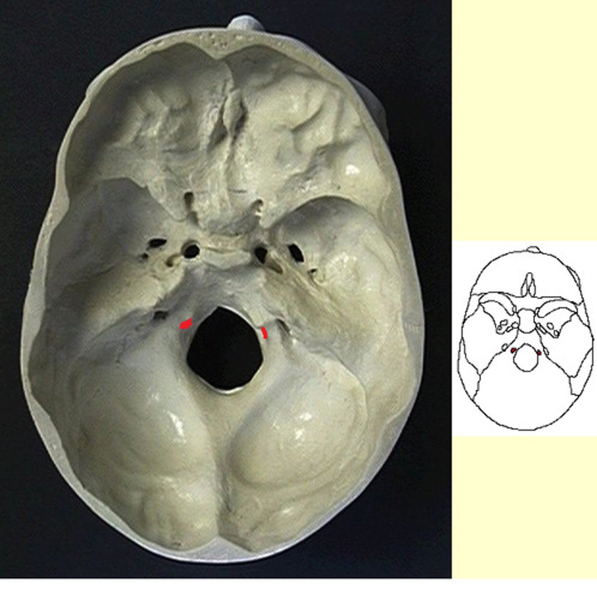 <p>anterior to occipital condyles</p>
