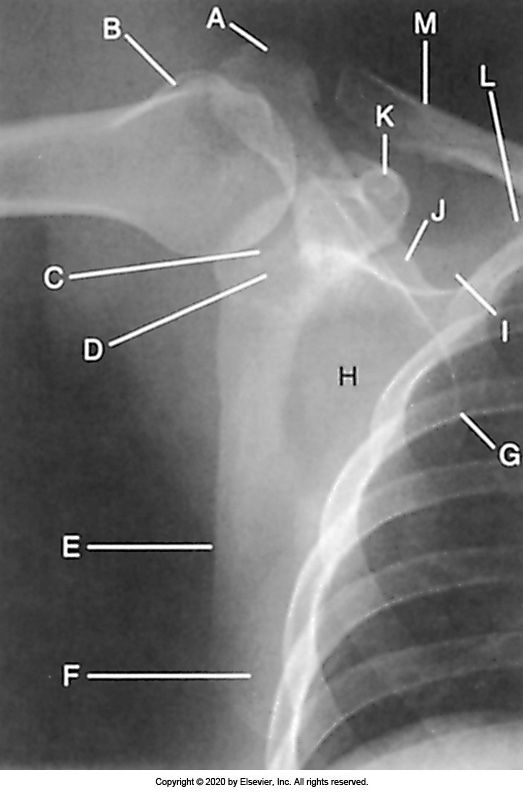 <p>Identify the labeled "E" anatomy in the image below:</p><p>Medial border</p><p>&nbsp;</p><p>Glenoid cavity</p><p>&nbsp;</p><p>Lateral border</p><p>&nbsp;</p><p>Scapular body</p>