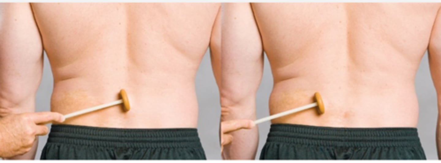 <p>With the Spinal Percussion Test, pain over the paraspinals indicates _____ or _____</p>