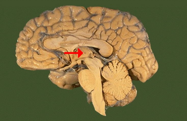 <p>Label this brain part</p>