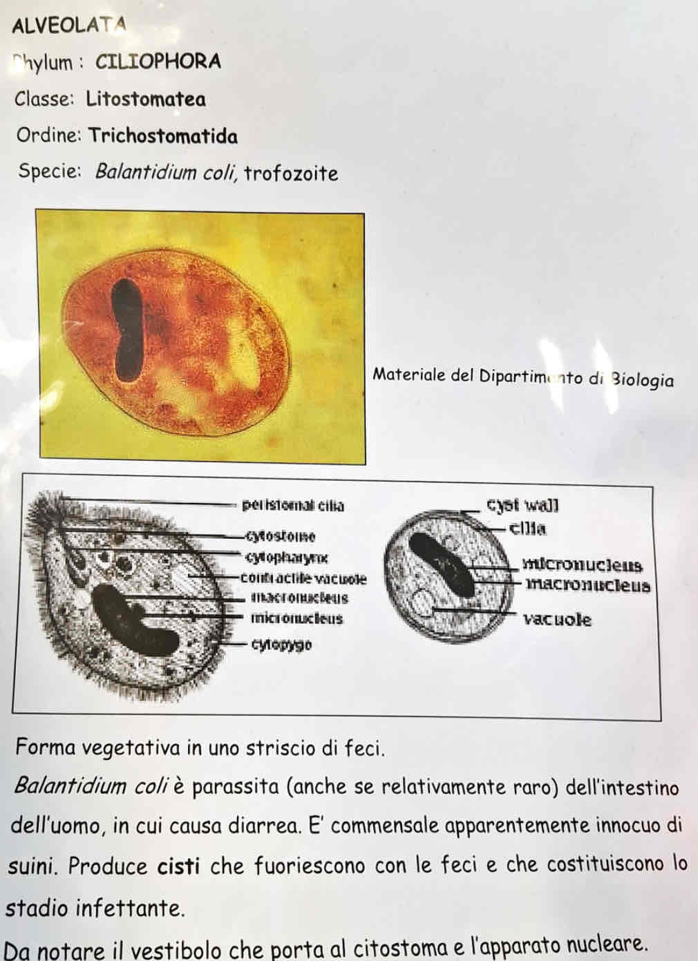 <p><em>Balantidium coli</em></p>