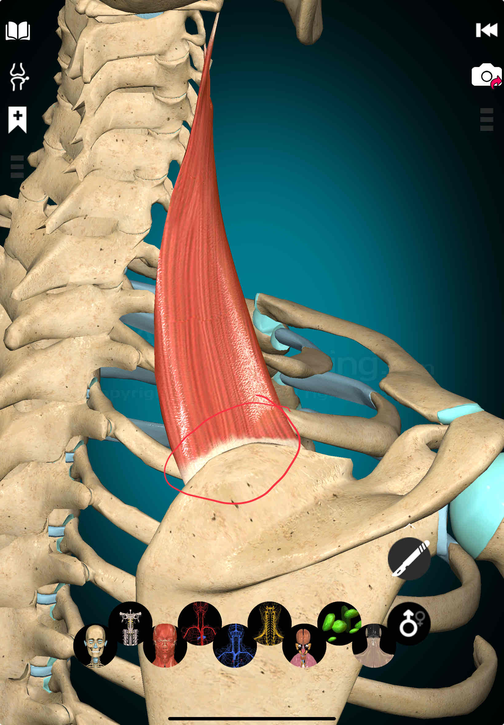 <p>Levator Scapulae Insertion </p>