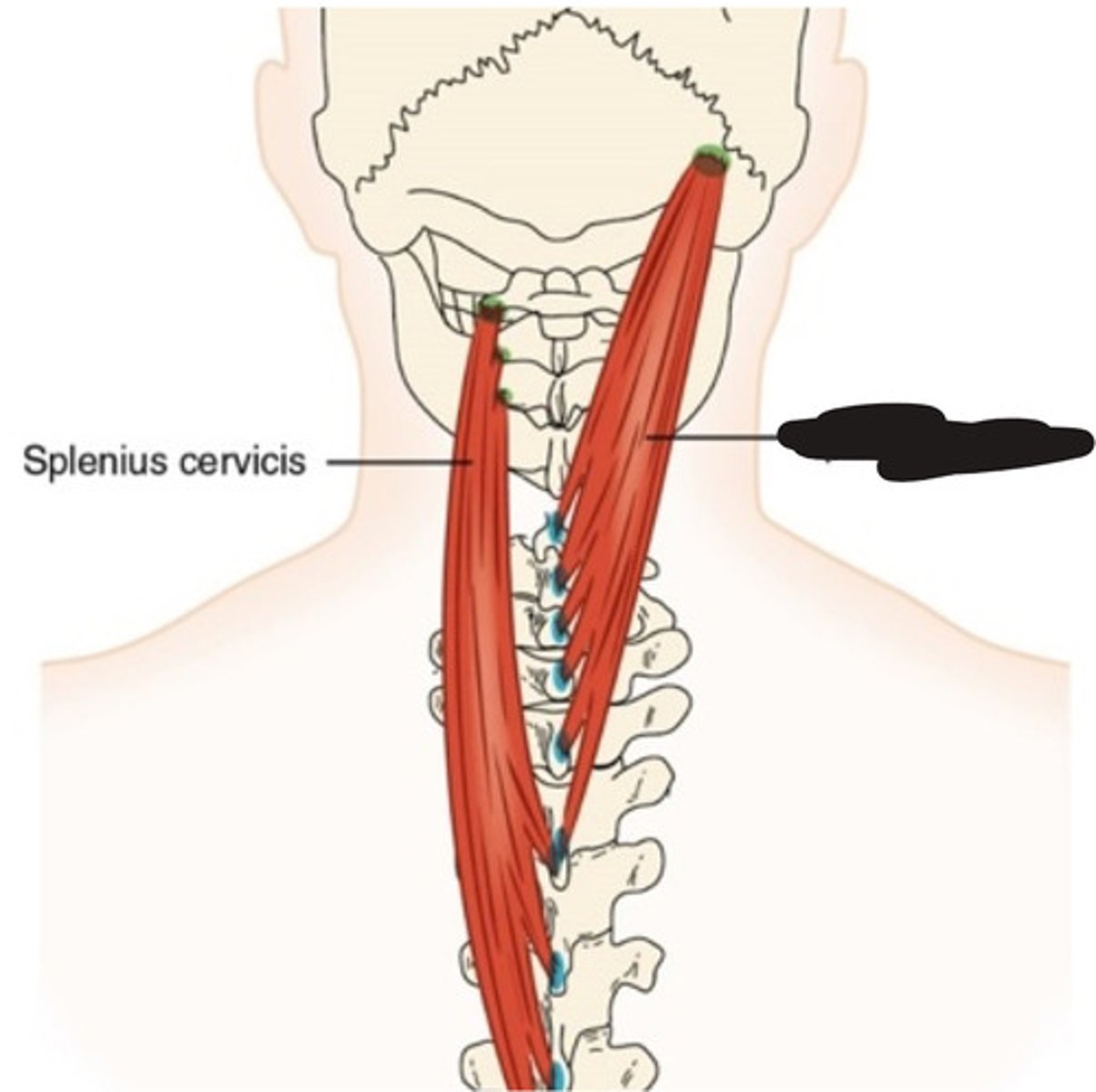 <p>What muscle is this?</p>
