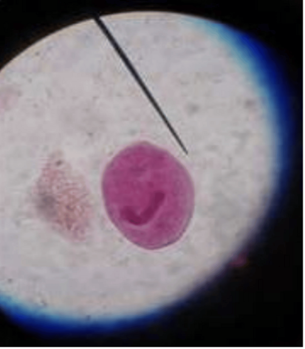 <p>Balantidium coli - trophozoite</p>