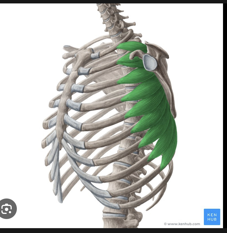 <p>Identify the highlighted muscle</p>