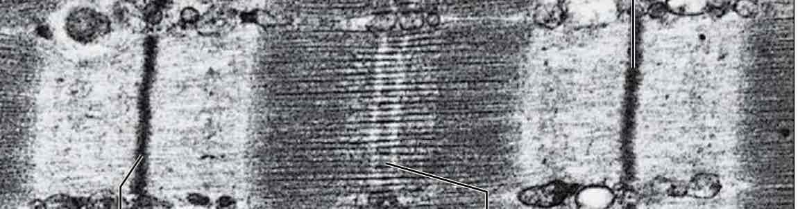 <p>Starting from the two black lines going in, what id that called </p>
