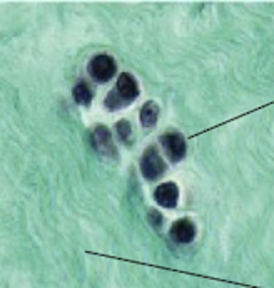 <p>What would this be called in a fibrocartilage?</p>