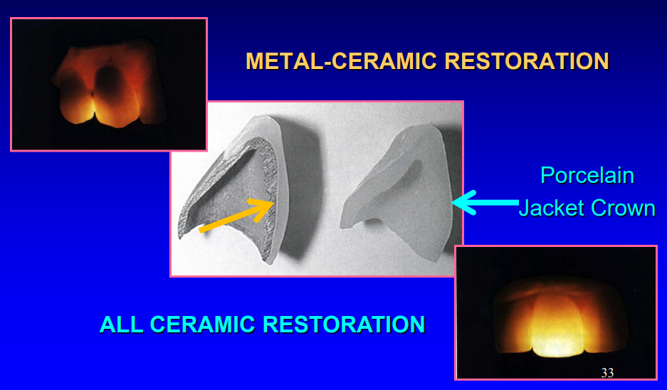 <ul><li><p>metal-ceramic restoration </p></li><li><p>all ceramic restoration </p></li></ul><p></p>