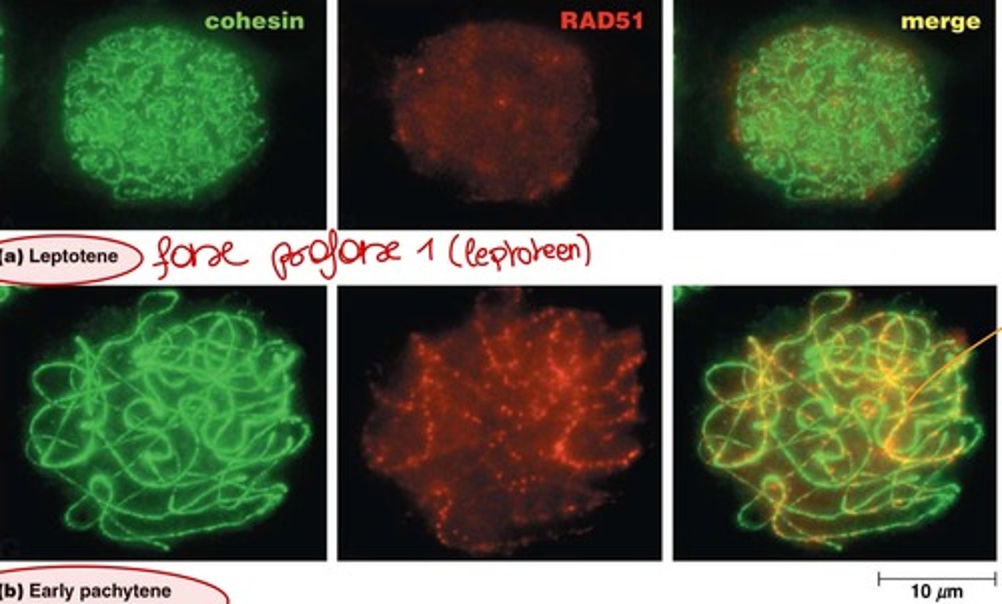 <p>1) RAD51 is een essentieel enzym dat een cruciale rol speelt in het herstel van DNA. Het helpt bij het herstellen van dubbele DNA-breuken door middel van homologe recombinatie. Dit proces omvat het uitwisselen van DNA-strengen tussen complementaire DNA-moleculen om beschadigd DNA te herstellen en te behouden1.</p><p>2) komt tot expressie in het pachyteen (fase in profase I)</p>