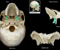 <p>Point of origin for internal and external pterygoid muscles.</p>