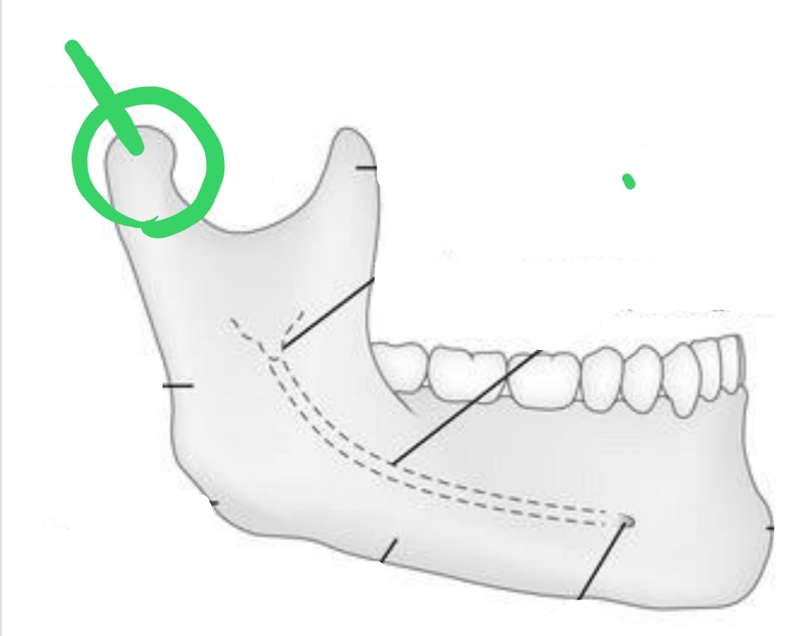<p>Ball-shaped portion distal to Sigmoid notch; contacts with temporal bone to form TMJ</p>