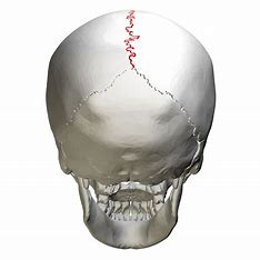 <p>what suture is this?</p>