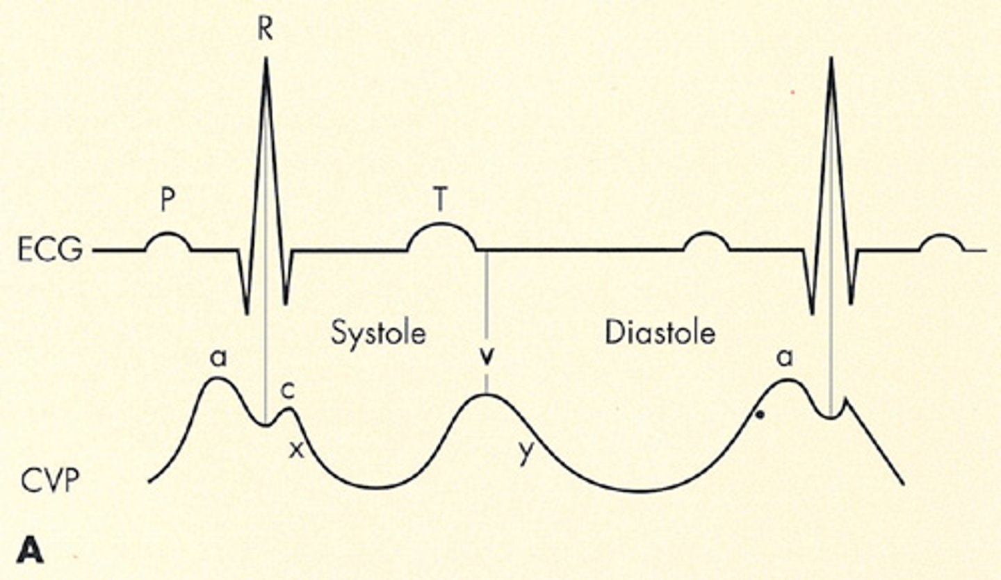 <p>Normal CVP</p>