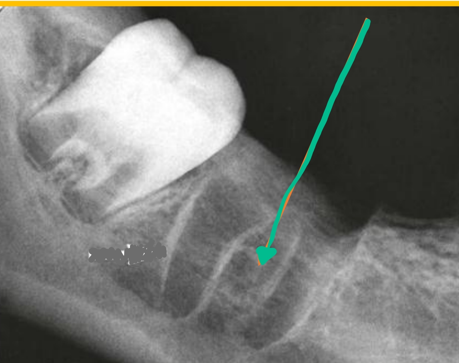 <p>located between roots</p>