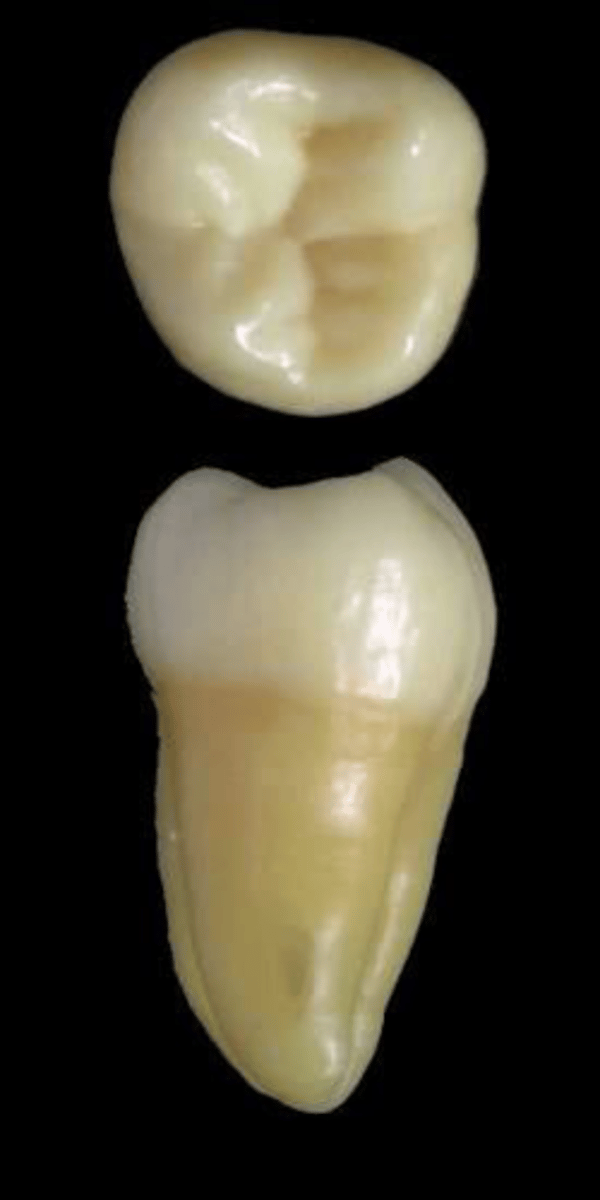 <p>what tooth is this &amp; why?</p>