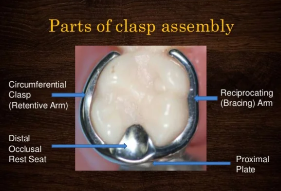 <ul><li><p>type of direct retention</p></li><li><p>acts as direct retainer and/or stabiliser by partially encompassing or contacting abutment tooth</p></li><li><p>Components include: clasp, cingulum, incisal/occlusal rest and minor connector</p></li></ul><p></p>