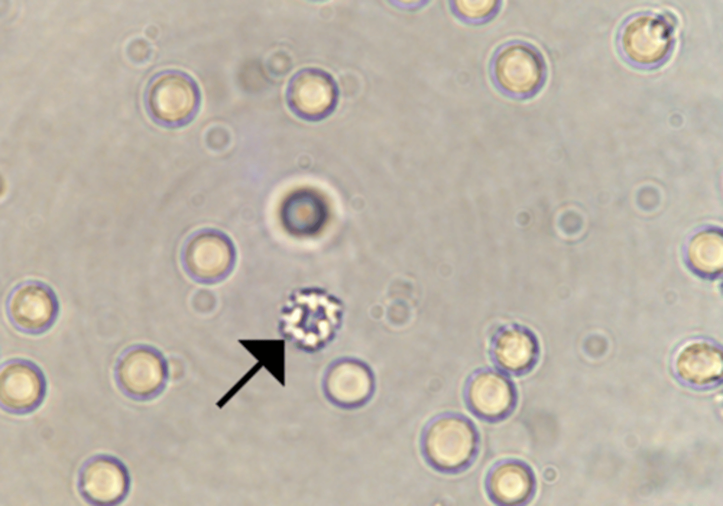 <p>appears when urine is too concentrated</p>