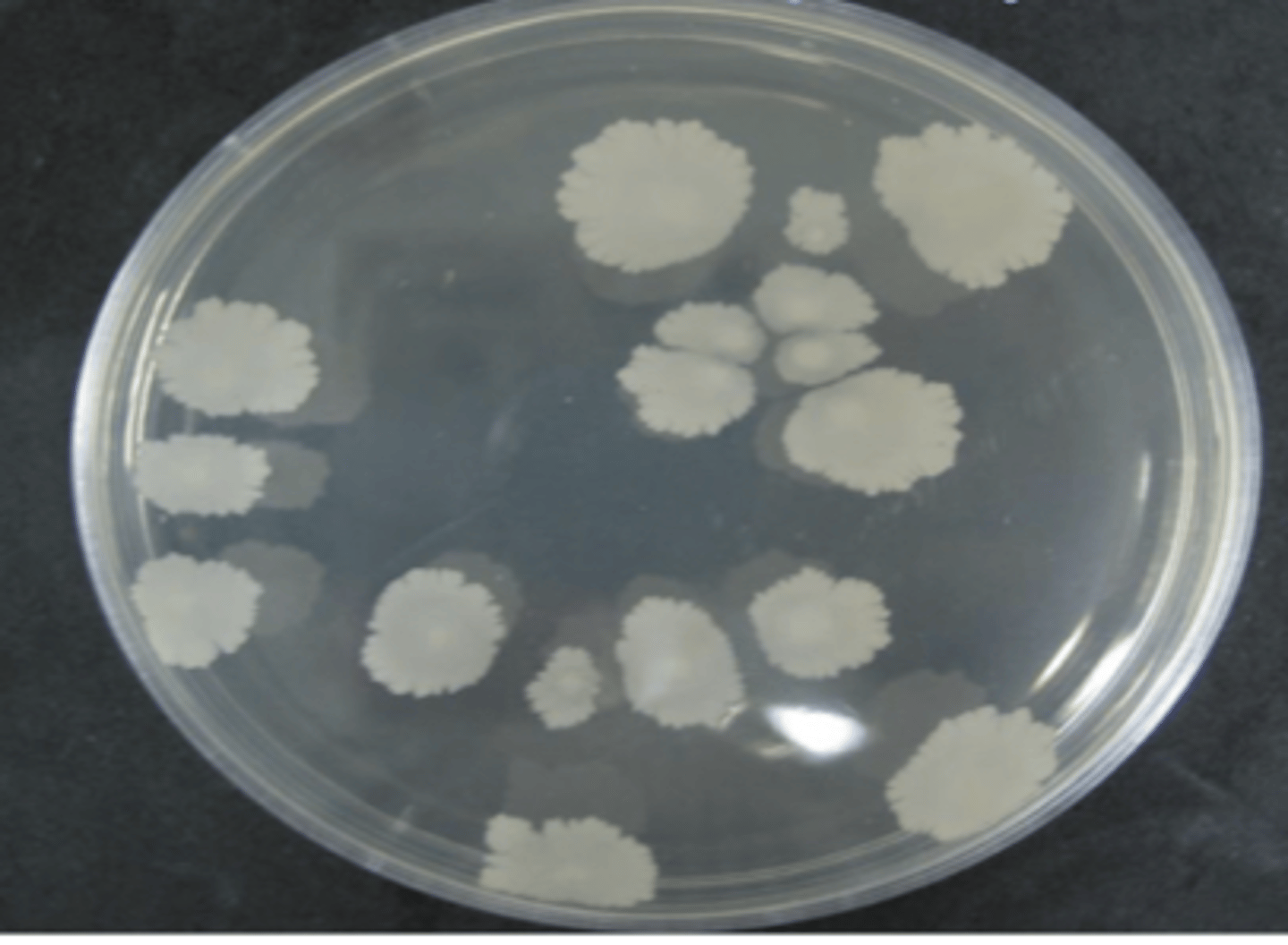 <p>which bacteria is this, on non enriched media?</p>
