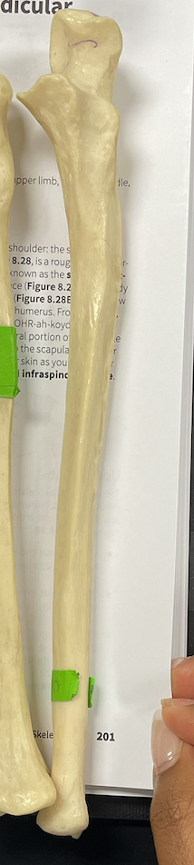 <p>Name this Bone?</p>