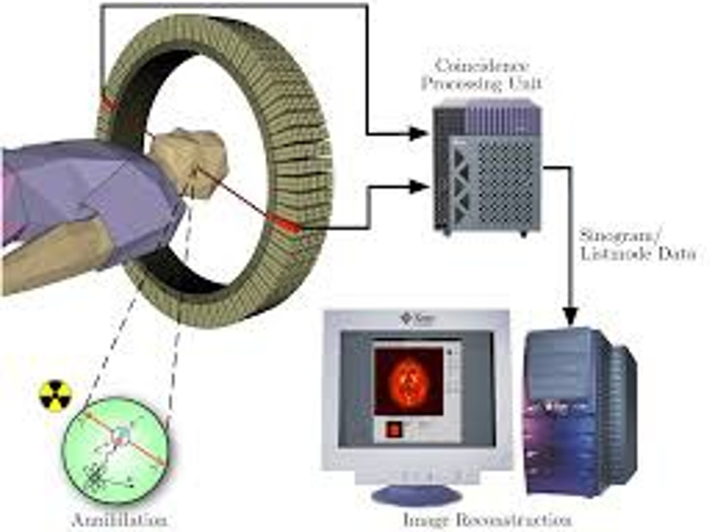 <p>a visual display of brain activity that detects where a radioactive form of glucose goes while the brain performs a given task.</p>