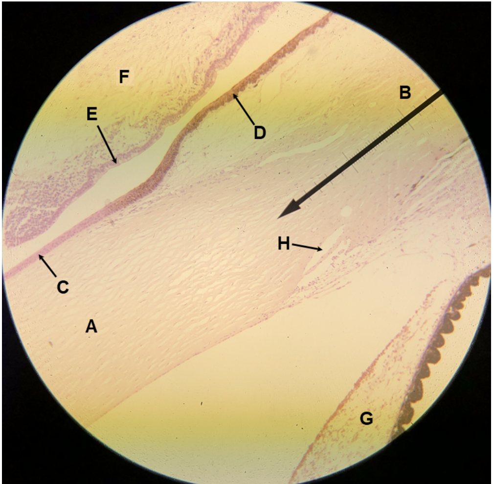 <p><span><span>In the image above, identify structures/parts of the eye wall A and B, structures/tissues C-E, and structures F-H.&nbsp;</span></span></p>