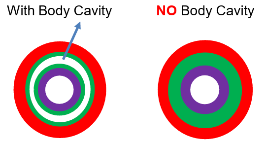 <p>A <strong>space surrounded by mesoderm tissue</strong>, separate from the digestive cavity.</p>