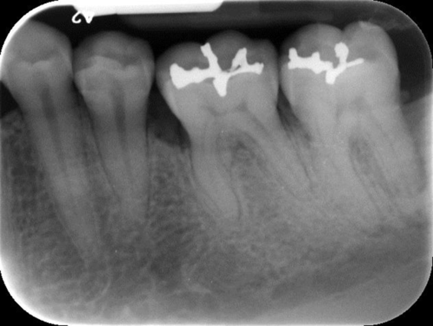 <p>What is this error?</p>