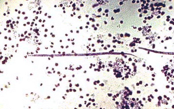 <p><span>This was found in the blood of a dog. What is it? </span></p>