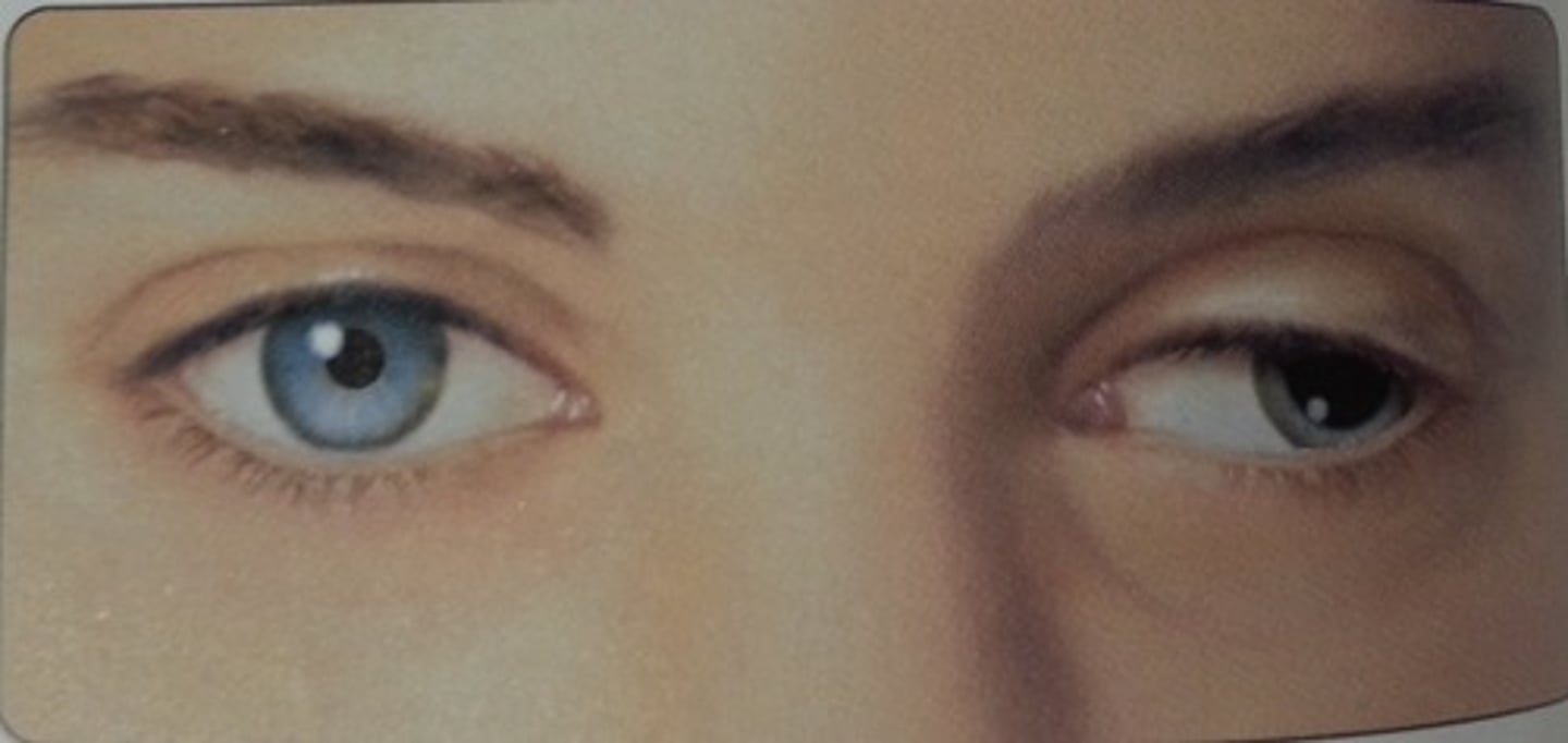 <p>-trochlear<br>-motor: moves eye down, laterally, medially<br>-muscle: superior oblique</p>