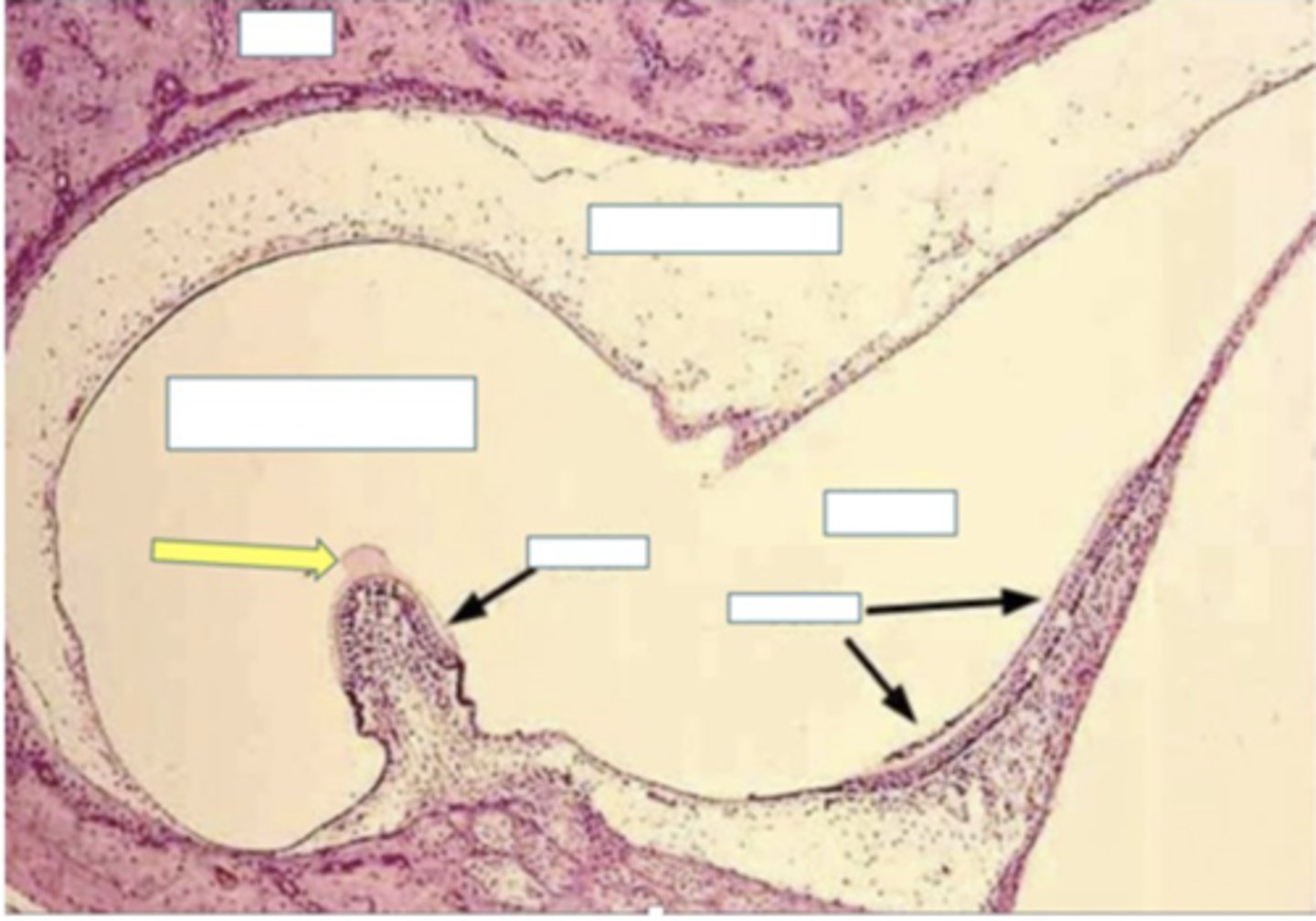 <p>Identify the following structure (YELLOW ARROW)</p>