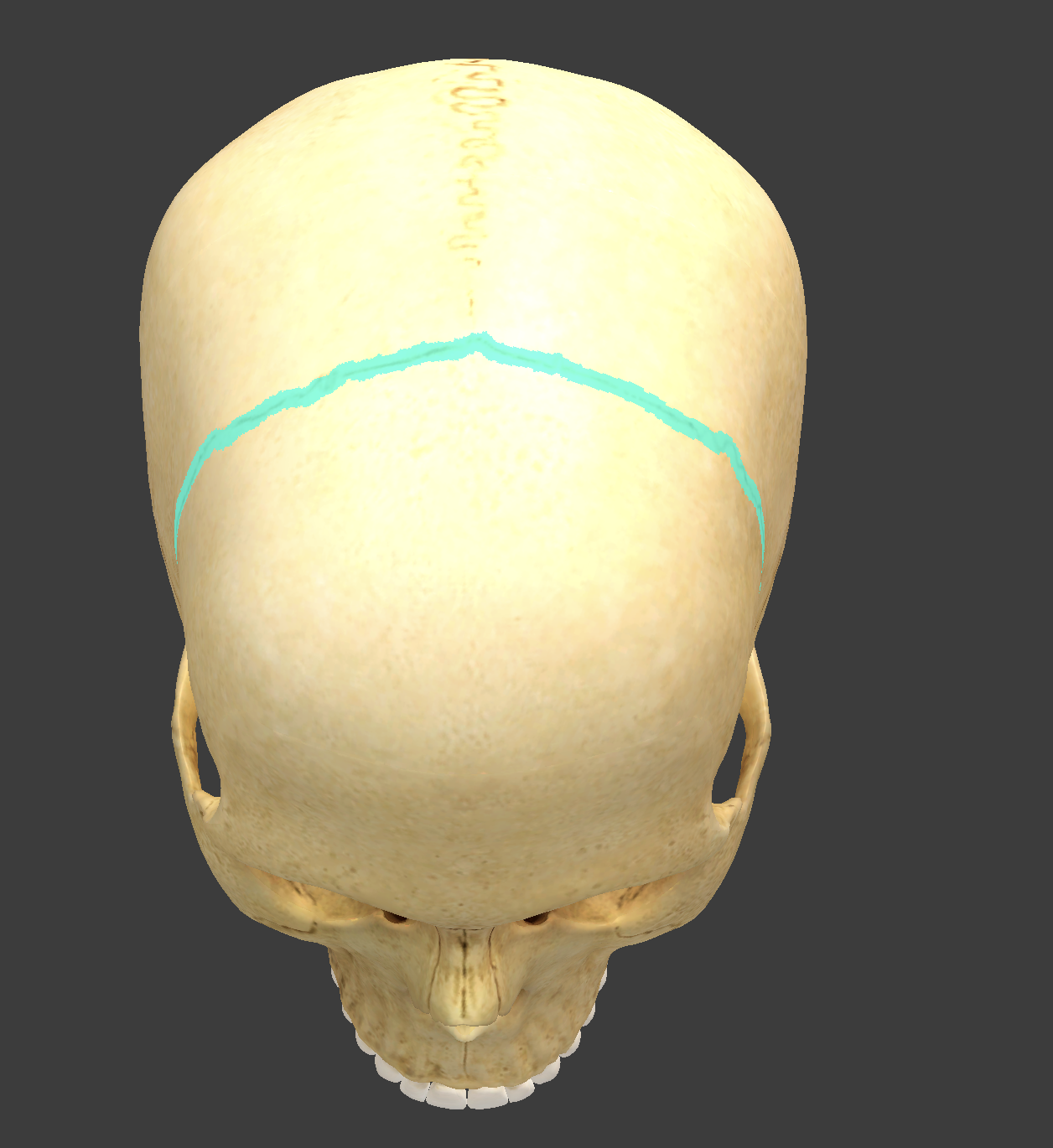 <p>what is this suture?</p>